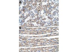 Immunohistochemical staining (Formalin-fixed paraffin-embedded sections) of human liver (A) and human heart (B) with DLX5 polyclonal antibody  at 4-8 ug/mL working concentration. (DLX5 antibody  (N-Term))
