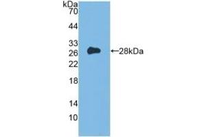 Detection of Recombinant Flt3, Mouse using Polyclonal Antibody to FMS Like Tyrosine Kinase 3 (Flt3) (FLT3 antibody  (AA 335-544))