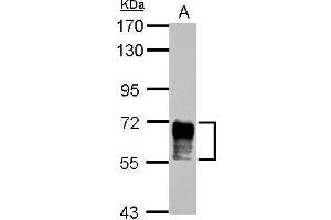 WB Image Sample (30 ug of whole cell lysate) A: A431 7. (NAB2 antibody)