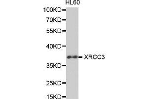 Western Blotting (WB) image for anti-X-Ray Repair Complementing Defective Repair in Chinese Hamster Cells 3 (XRCC3) (AA 62-346) antibody (ABIN3023006)