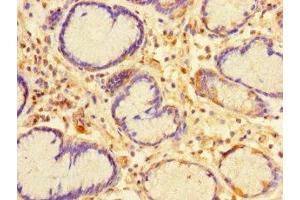 Immunohistochemistry of paraffin-embedded human stomach tissue using ABIN7146737 at dilution of 1:100 (CA11 antibody  (AA 24-328))