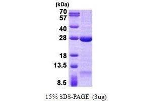 Figure annotation denotes ug of protein loaded and % gel used. (DNAL1 Protein)