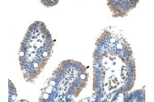 UBE2J2 antibody was used for immunohistochemistry at a concentration of 4-8 ug/ml to stain Epithelial cells of intestinal villus (arrows) in Human Intestine. (UBE2J2 antibody)