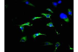 Immunofluorescence staining of U251 cells with ABIN7152849 at 1:466, counter-stained with DAPI. (FRS3 antibody  (AA 101-400))