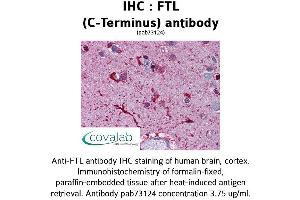 Image no. 1 for anti-Ferritin, Light Polypeptide (FTL) (C-Term) antibody (ABIN1734480) (FTL antibody  (C-Term))