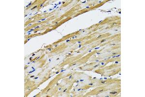 Immunohistochemistry of paraffin-embedded rat heart using GOT1 antibody (ABIN2562884) at dilution of 1:100 (40x lens). (GOT1 antibody)