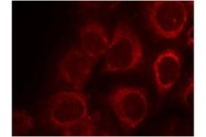 Image no. 1 for anti-SMAD, Mothers Against DPP Homolog 1 (SMAD1) (AA 461-465) antibody (ABIN319351) (SMAD1 antibody  (AA 461-465))