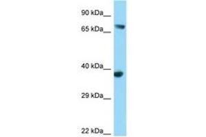 Image no. 1 for anti-FYN-Binding Protein (FYB) (AA 39-88) antibody (ABIN6748114) (FYB antibody  (AA 39-88))