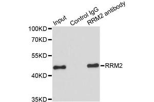 Immunoprecipitation analysis of 200ug extracts of HeLa cells using 1ug RRM2 antibody. (RRM2 antibody)