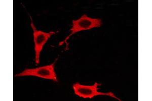 ABIN6267259 staining BT-20 cells by ICC/IF. (EGFR antibody  (pThr693))