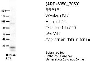 Image no. 2 for anti-Ribosomal RNA Processing 1 Homolog B (RRP1B) (Middle Region) antibody (ABIN405769)