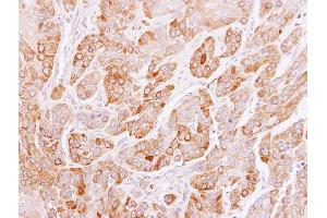 IHC-P Image Immunohistochemical analysis of paraffin-embedded SCC4 xenograft, using PEF1, antibody at 1:100 dilution. (PEF1 antibody)