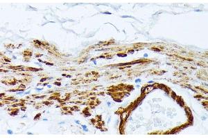 Immunohistochemistry of paraffin-embedded Human stomach using TPM2 Polyclonal Antibody at dilution of 1:100 (40x lens). (TPM2 antibody)