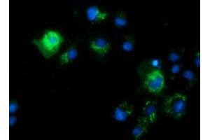Anti-CALCOCO2 mouse monoclonal antibody (ABIN2453950) immunofluorescent staining of COS7 cells transiently transfected by pCMV6-ENTRY CALCOCO2 (RC203843). (CALCOCO2 antibody)