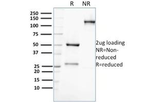 SDS-PAGE (SDS) image for anti-Aldo-keto Reductase Family 1, Member C2 (AKR1C2) antibody (ABIN6939232)