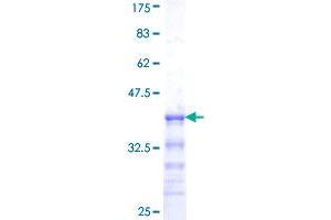 SOX10 Protein (AA 336-433) (GST tag)