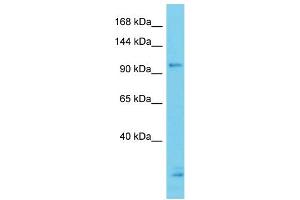 Host: Rabbit Target Name: CCDC132 Sample Type: ACHN Whole cell lysates Antibody Dilution: 1. (Syndetin/VPS50 antibody  (N-Term))