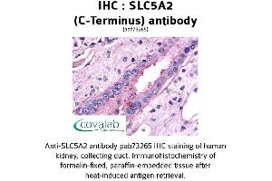 Image no. 1 for anti-Solute Carrier Family 5 (Sodium/glucose Cotransporter), Member 2 (SLC5A2) (C-Term) antibody (ABIN1739396) (SLC5A2 antibody  (C-Term))