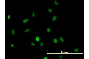 Immunofluorescence of monoclonal antibody to HDAC1 on HeLa cell. (HDAC1 antibody  (AA 1-482))