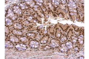 IHC-P Image KLF4 antibody detects KLF4 protein at nucleus on mouse colon by immunohistochemical analysis.