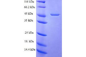 SDS-PAGE (SDS) image for Fibroblast Growth Factor 10 (FGF10) (AA 38-208) protein (GST tag) (ABIN5709519)