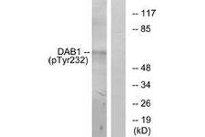 Western blot analysis of extracts from LOVO cells, using Dab1 (Phospho-Tyr232) Antibody. (DAB1 antibody  (pTyr232))
