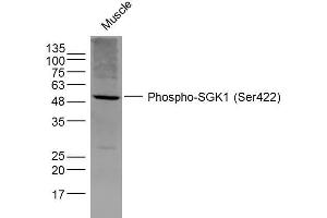 Mouse Muscle lysates probed with SGK1 (Ser422) Polyclonal Antibody, Unconjugated  at 1:300 dilution and 4˚C overnight incubation. (SGK1 antibody  (pSer422))
