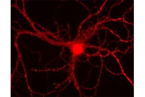 Indirect immunostaining of rat hippocampus neurons (dilution 1 : 500). (CAMK1 antibody)