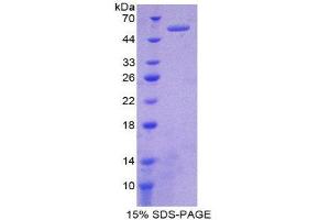 SDS-PAGE (SDS) image for Complement Factor I (CFI) (AA 28-243) protein (His tag,GST tag) (ABIN2122696)