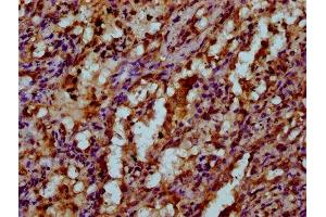 IHC image of ABIN7175529 diluted at 1:200 and staining in paraffin-embedded human lung tissue performed on a Leica BondTM system. (VKORC1 antibody  (AA 30-74))