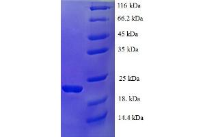 SDS-PAGE (SDS) image for Interferon, alpha 21 (IFNa21) (AA 24-189) protein (His tag) (ABIN5709715)