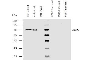 Western blotting analysis of human AGPS using mouse monoclonal antibody AGPS-03 on lysates of HEP-G2 and Molt-4 cells, and MCF-7 cells (negative control) under reducing and non-reducing conditions.