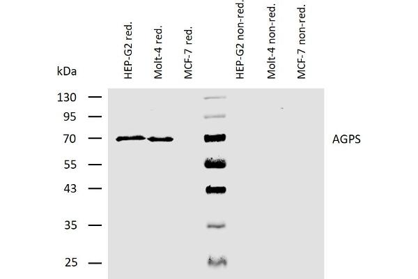 AGPS anticorps  (AA 158-384)