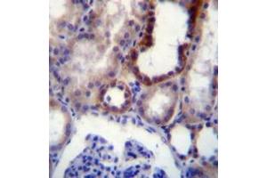 Immunohistochemistry analysis in formalin fixed and paraffin embedded (FFPE) human kidney tissue using CD316 / IGSF8 Antibody , followed by peroxidase conjugation of the secondary antibody and DAB staining.