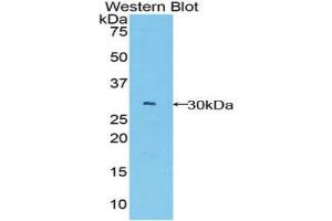 Western blot analysis of the recombinant protein. (BCL3 antibody  (AA 127-376))
