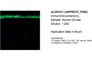 Sample Type: Human CorneaDilution: 1:200 (ALDH1A1 antibody  (Middle Region))