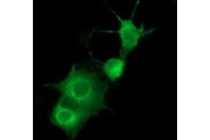 Image no. 3 for anti-Platelet Derived Growth Factor Receptor beta (PDGFRB) antibody (ABIN1500102) (PDGFRB antibody)