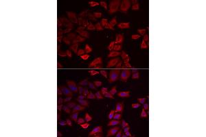 Immunofluorescence analysis of HeLa cells using SEPHS1 antibody (ABIN5973853).