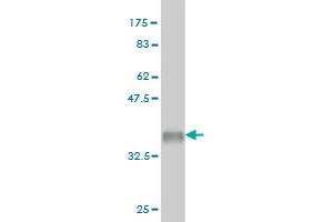 Western Blot detection against Immunogen (35. (EIF5A2 antibody  (AA 66-153))