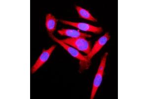 IF analysis of KLC1 using anti-KLC1 antibody (ABIN7599469). (KLC1 antibody  (AA 1-537))
