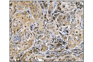 IHC analysis of Caspase-9/CASP9 using anti-Caspase-9/CASP9 antibody (ABIN7600340). (Caspase 9 antibody  (AA 18-416))