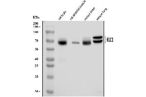 Western blot analysis of KLC1 using anti-KLC1 antibody (ABIN7599469). (KLC1 antibody  (AA 1-537))