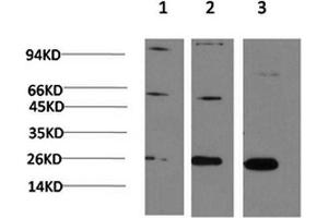 Western Blotting (WB) image for anti-Chromobox Homolog 3 (CBX3) antibody (ABIN5958632) (CBX3 antibody)