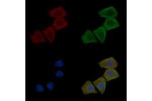 ABIN7096961 and ABIN7101028 staining Hela cells(30 min of UV treatment) by IF/ICC.