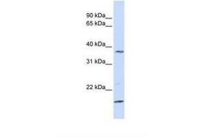 Image no. 1 for anti-Zinc Finger, DHHC-Type Containing 19 (ZDHHC19) (N-Term) antibody (ABIN6739186) (ZDHHC19 antibody  (N-Term))