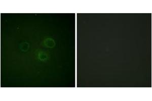 Immunofluorescence analysis of A549 cells, using CD226/DNAM-1 (Phospho-Ser329) Antibody. (CD226 antibody  (pSer329))