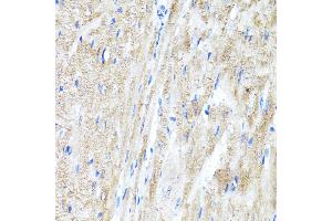Immunohistochemistry of paraffin-embedded Rat heart using IFN antibody (ABIN3015562, ABIN3015563, ABIN3015564 and ABIN6218872) at dilution of 1:100 (40x lens). (IFNAR2 antibody  (AA 27-243))