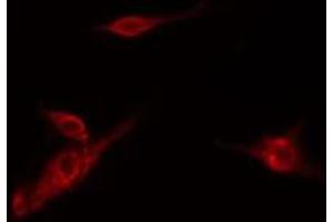 ABIN6278579 staining Hela cells by IF/ICC. (HK3 antibody  (Internal Region))