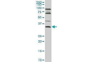 EPSTI1 monoclonal antibody (M01), clone 2A8 Western Blot analysis of EPSTI1 expression in A-431 . (EPSTI1 antibody  (AA 1-100))