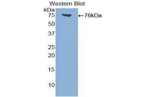 Western Blotting (WB) image for anti-Intercellular Adhesion Molecule 1 (ICAM1) (AA 26-480) antibody (ABIN1859239) (ICAM1 antibody  (AA 26-480))